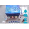 Human thyroid peroxidase (TPO) Elisa kit Y1076