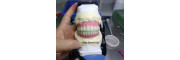 zirconia crown lab